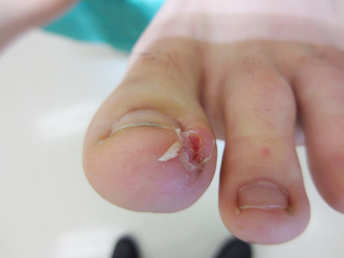 Nail